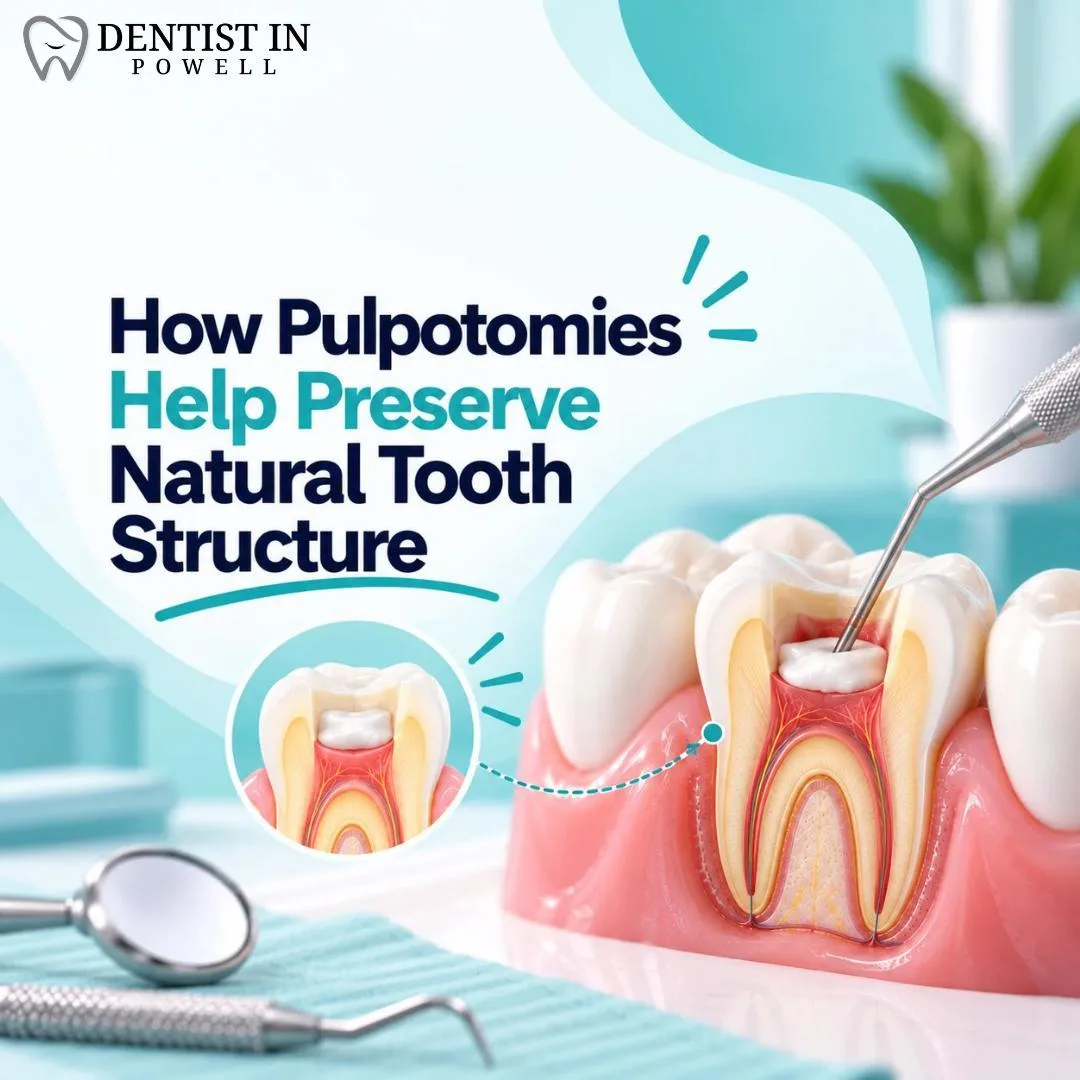 How Pulpotomies Help Preserve Natural Tooth Structure