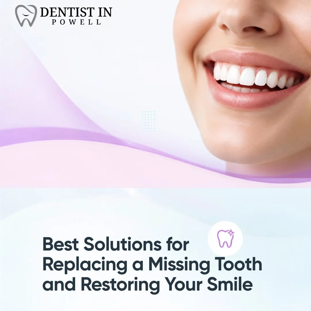 Best Solutions for Replacing a Missing Tooth and Restoring Your Smile