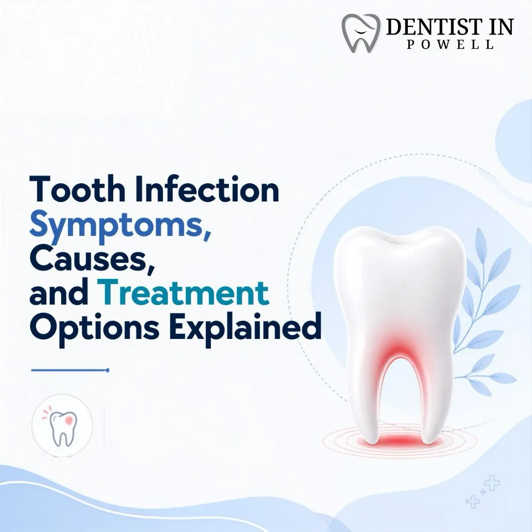 Tooth Infection Symptoms, Causes, and Treatment Options Explained