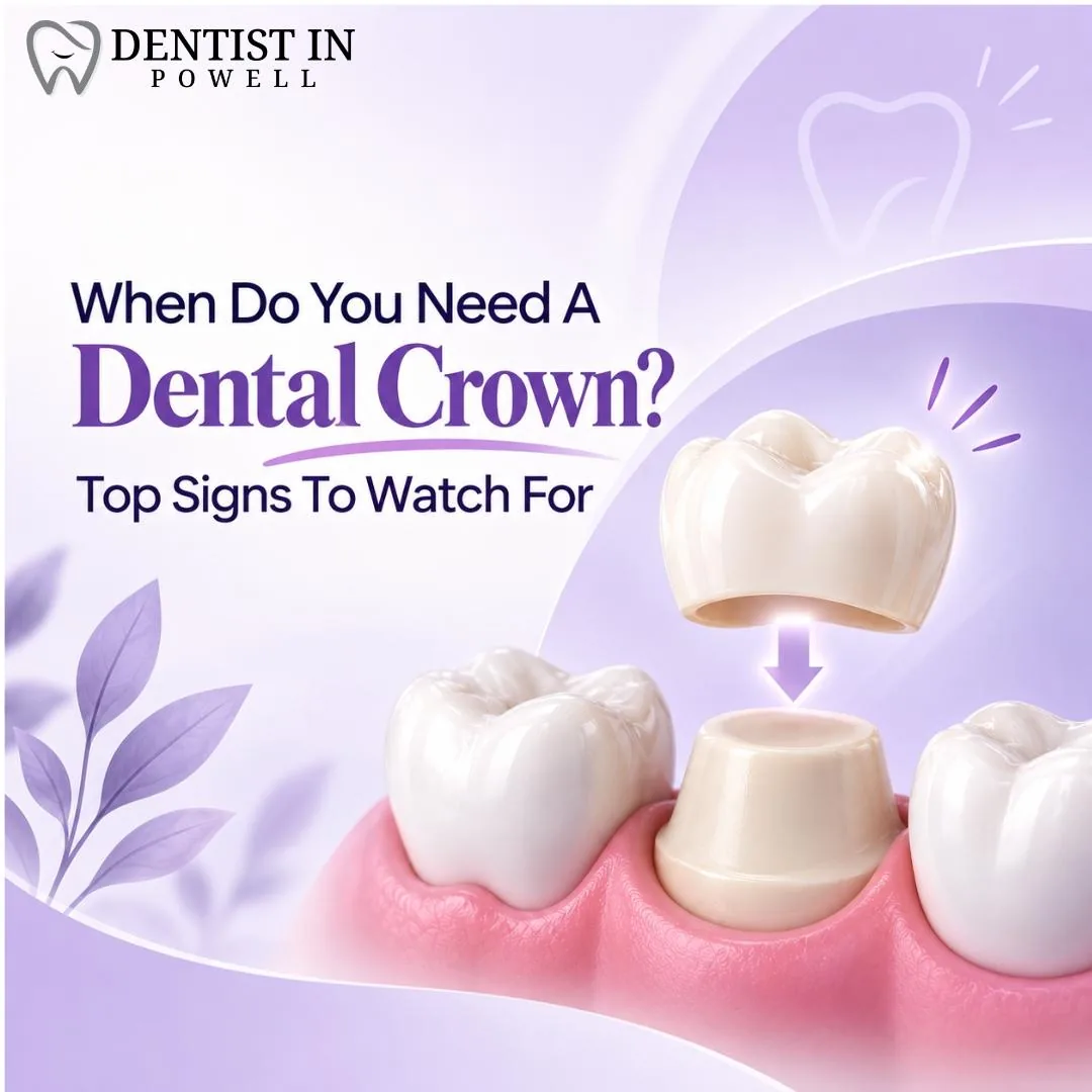 When Do You Need A Dental Crown? Top Signs To Watch For